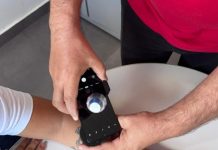 Telediagnóstico em dermatologia amplia acesso e identifica casos de câncer de pele em MS Category Template - London News PRO